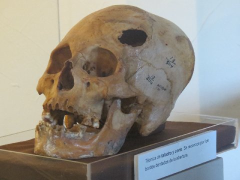 there is a human skull in the display
