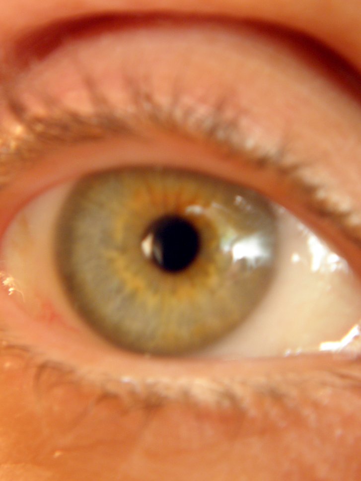 a close up view of a man's eye showing part of the iris