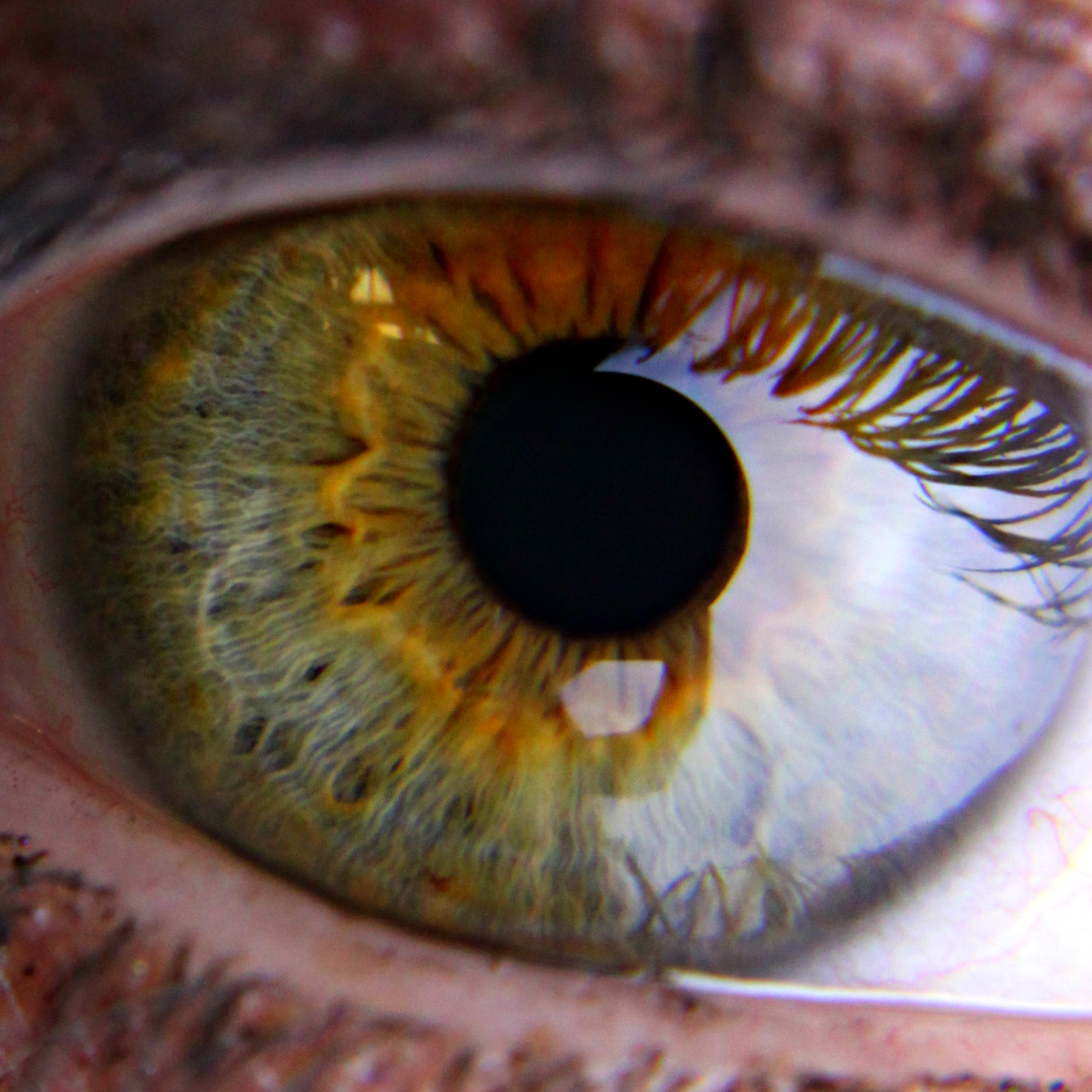 an eyeball shows the yellow, brown and orange colors