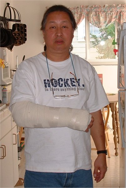 a man in a white shirt has an arm cast