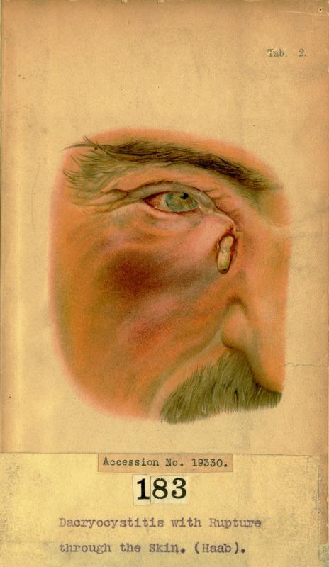 a drawing depicting the evolution of an eye, which has been described as being an early 20th century human