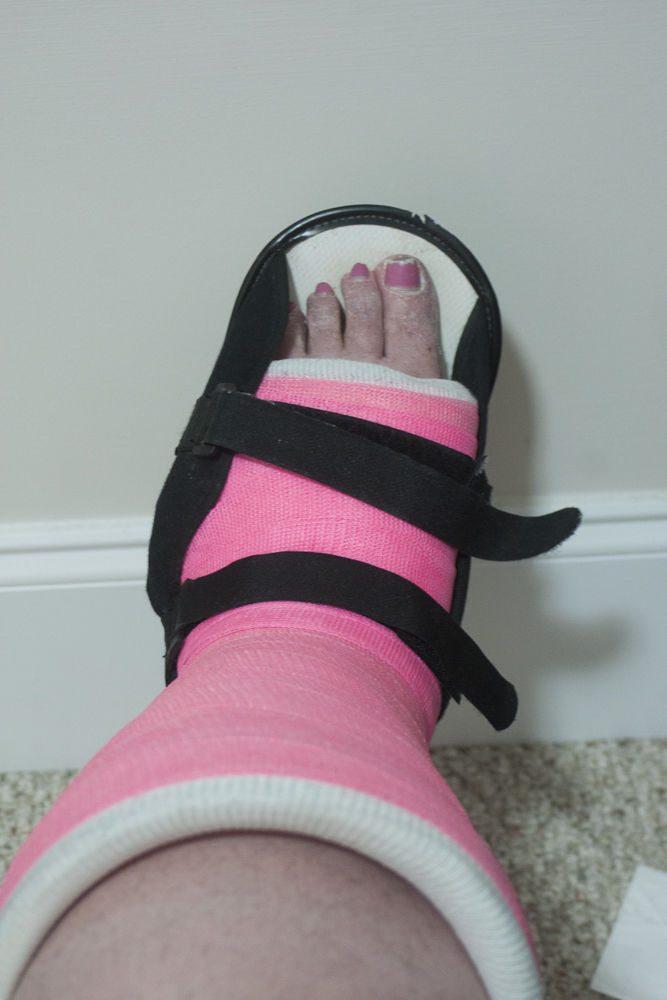 an injured foot with cramps and band wrapped around