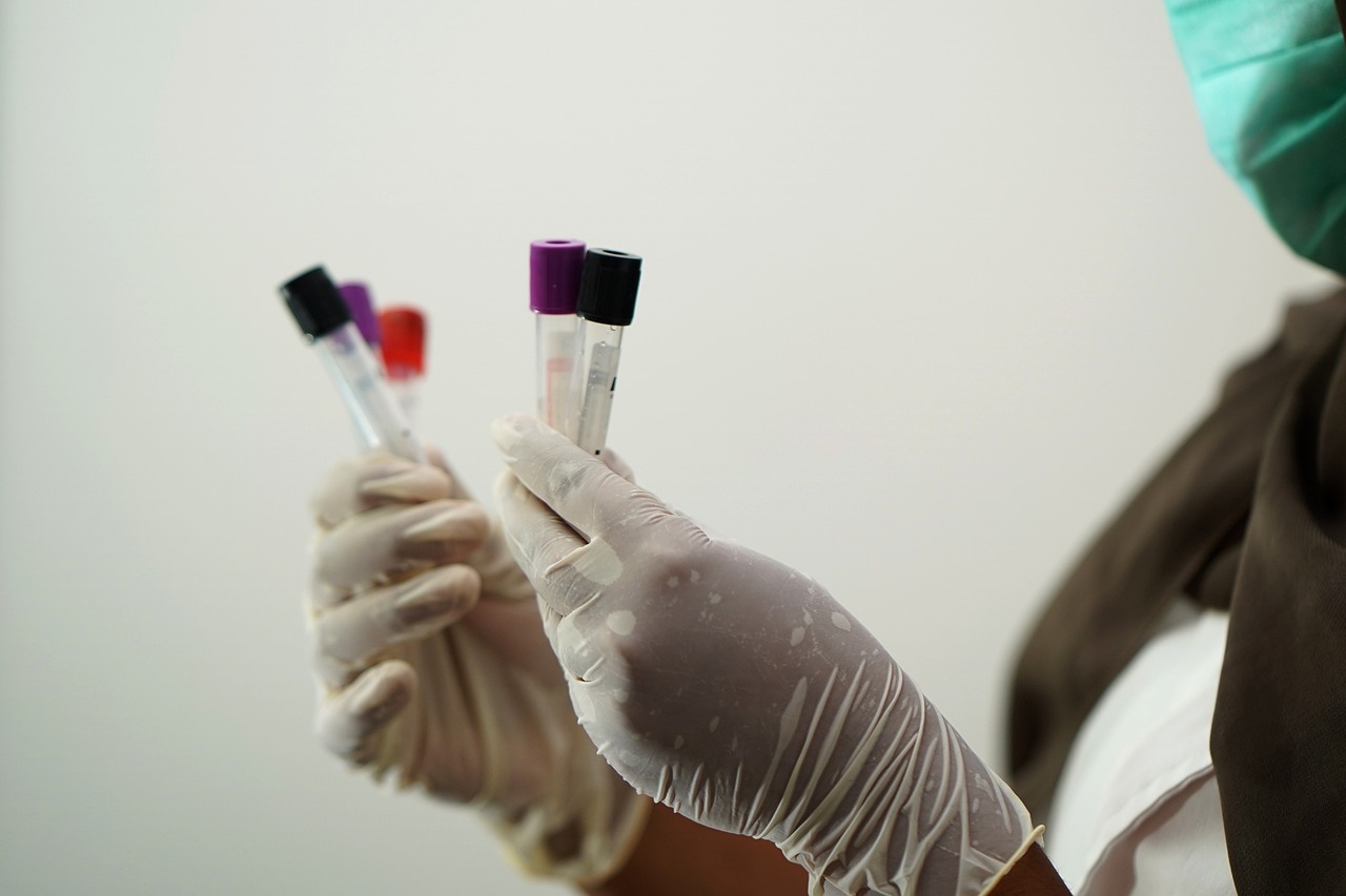 a close up of a person wearing gloves and gloves, a photo, pathology sample test tubes, purple and red color bleed, photographed for reuters, high res photo