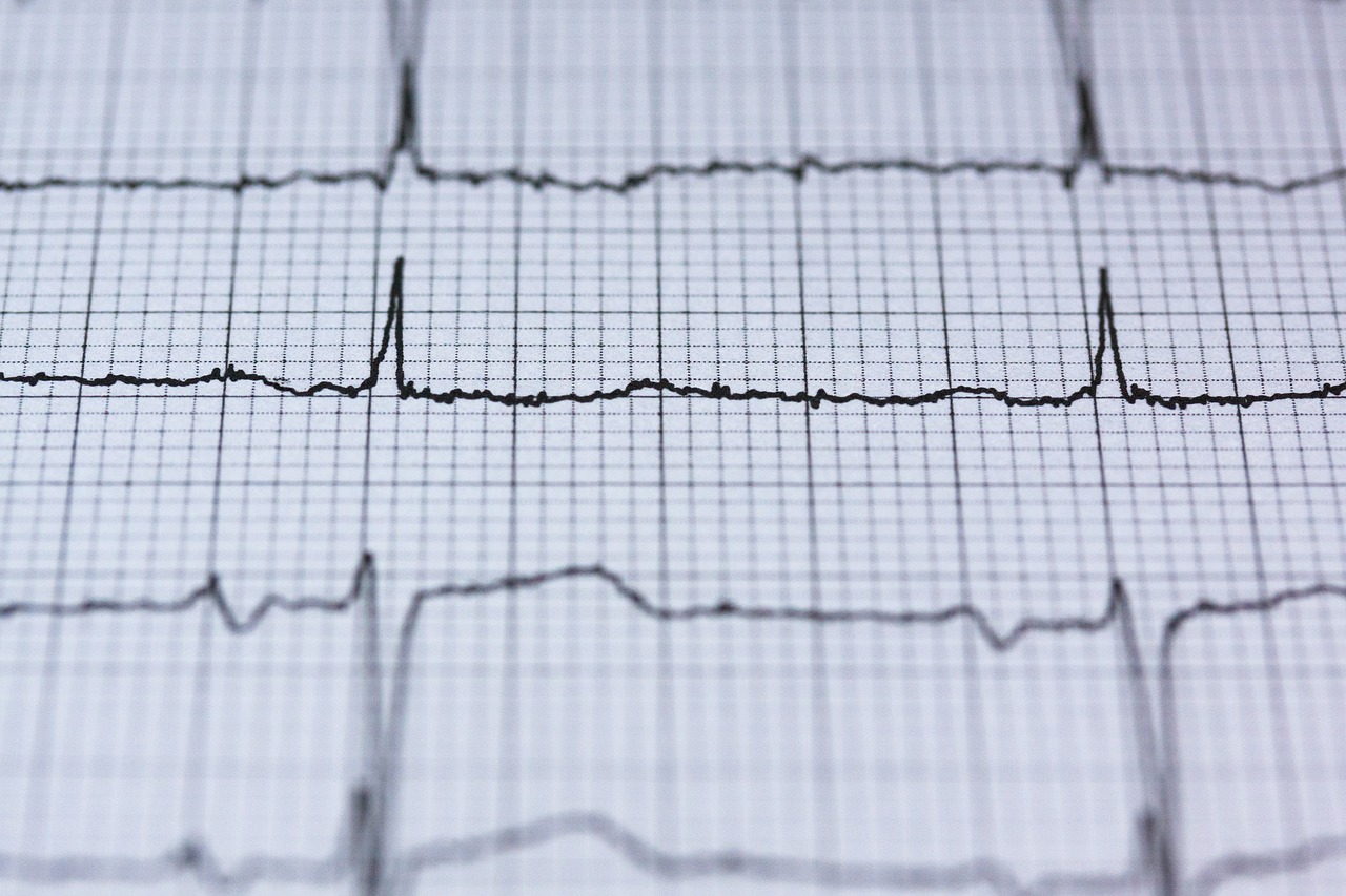 a close up of an ecg line on a piece of paper, a picture, by Jakob Gauermann, pexels, analytical art, heart effects, detailed grid as background, close up shot of an amulet, hospital