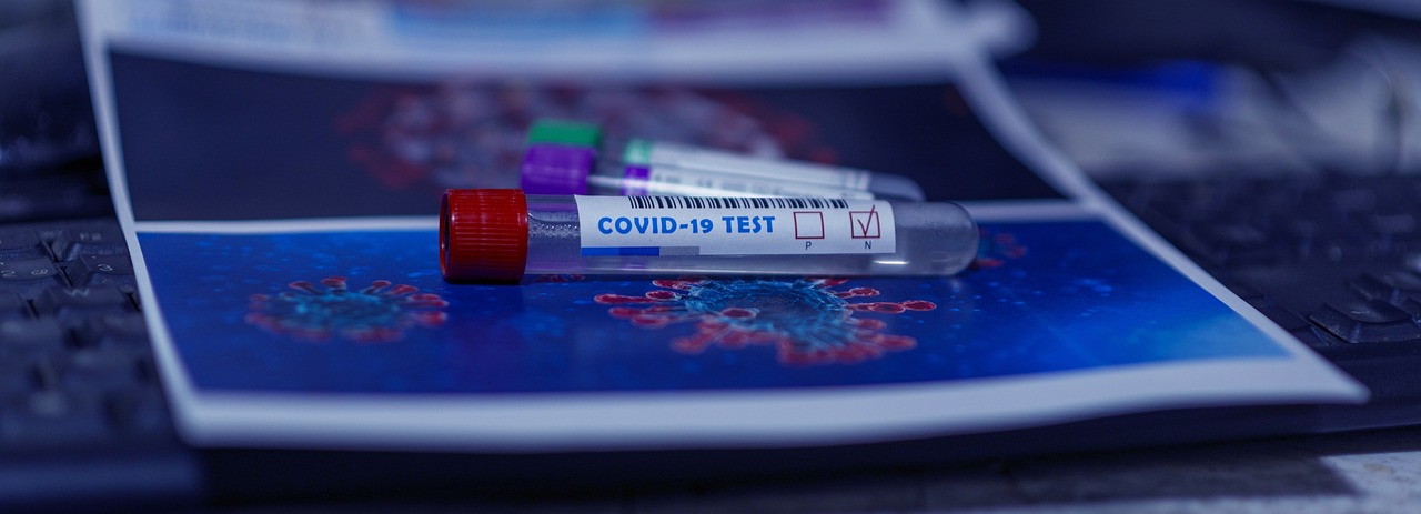 a tube of blood sitting on top of a computer keyboard, a picture, shutterstock, purism, coronavirus, test tubes, gauges, purple and blue colored