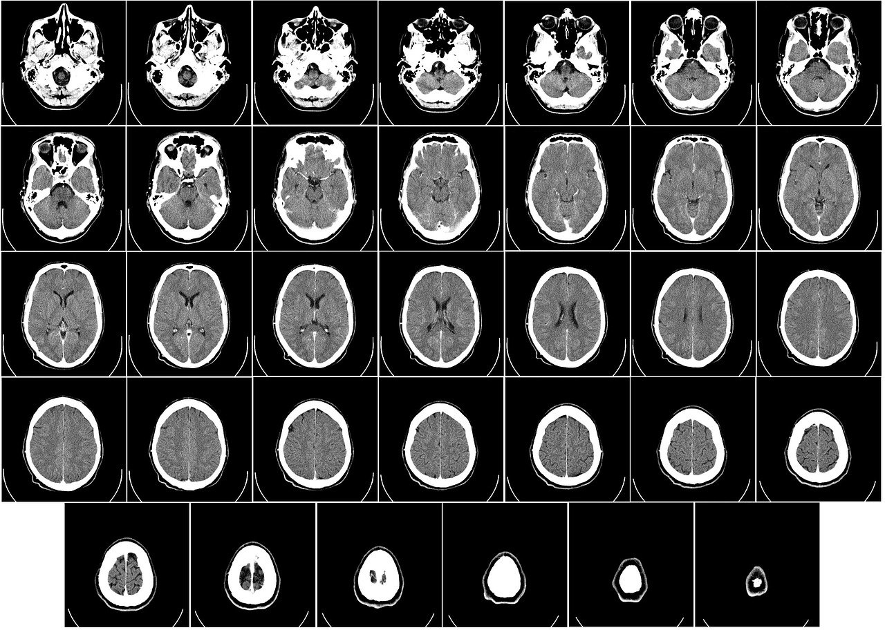 a black and white image of a brain scan, by Siona Shimshi, fine art, sprite sheet, high definition screenshot, orthodox, large strokes