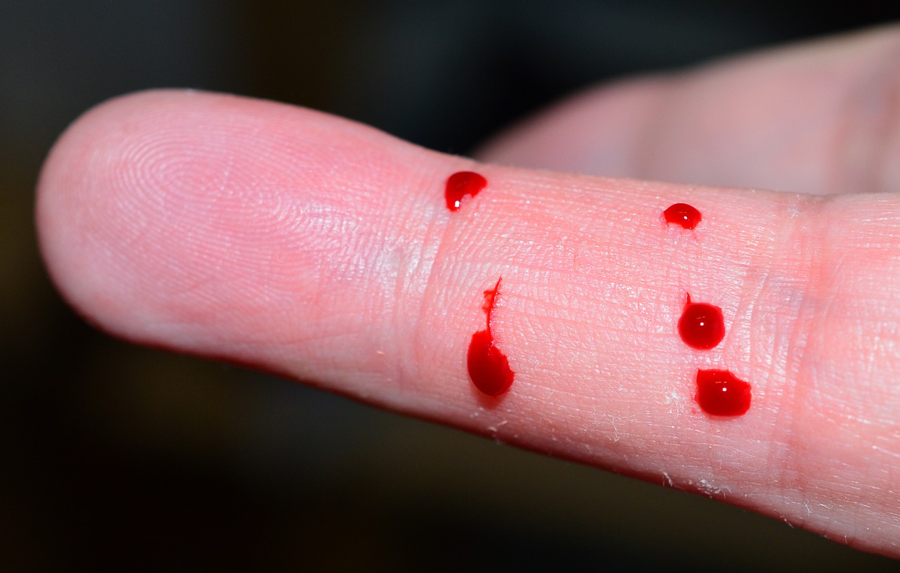 a close up of a person's finger with blood on it, a picture, by Jan Rustem, hurufiyya, many holes, full length shot, sharp tip, bite
