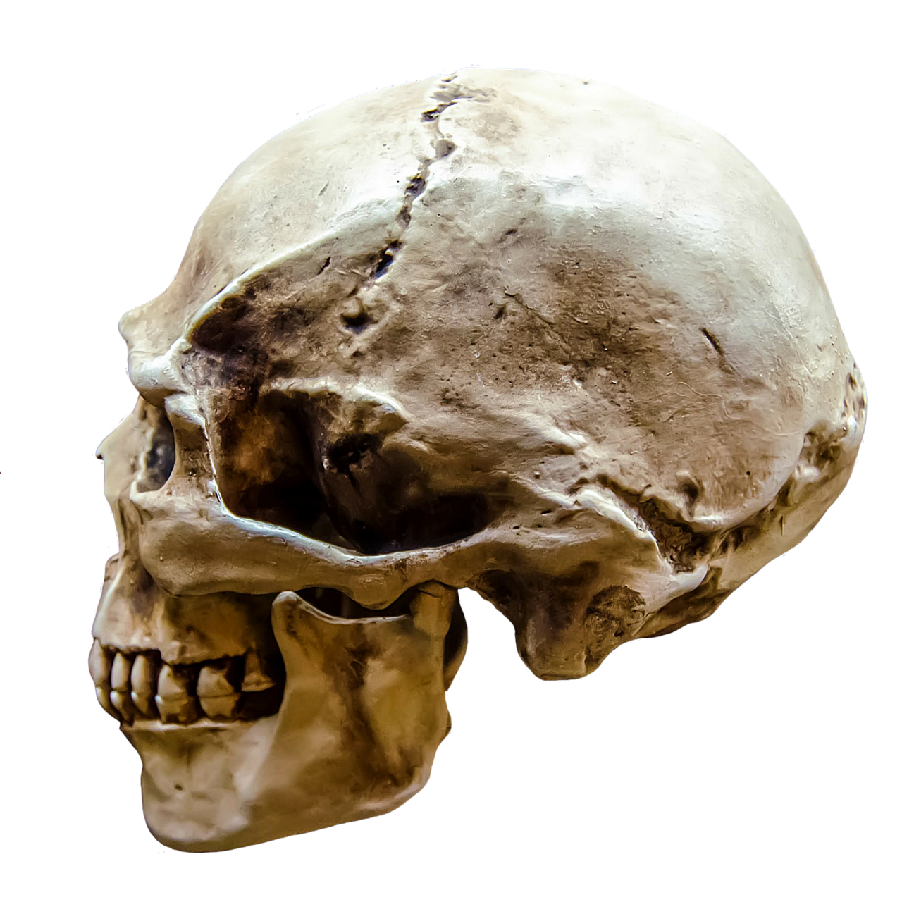 a close up of a human skull on a black background, shutterstock, side view profile centered, jpeg artifact, neanderthal people, prosthetics