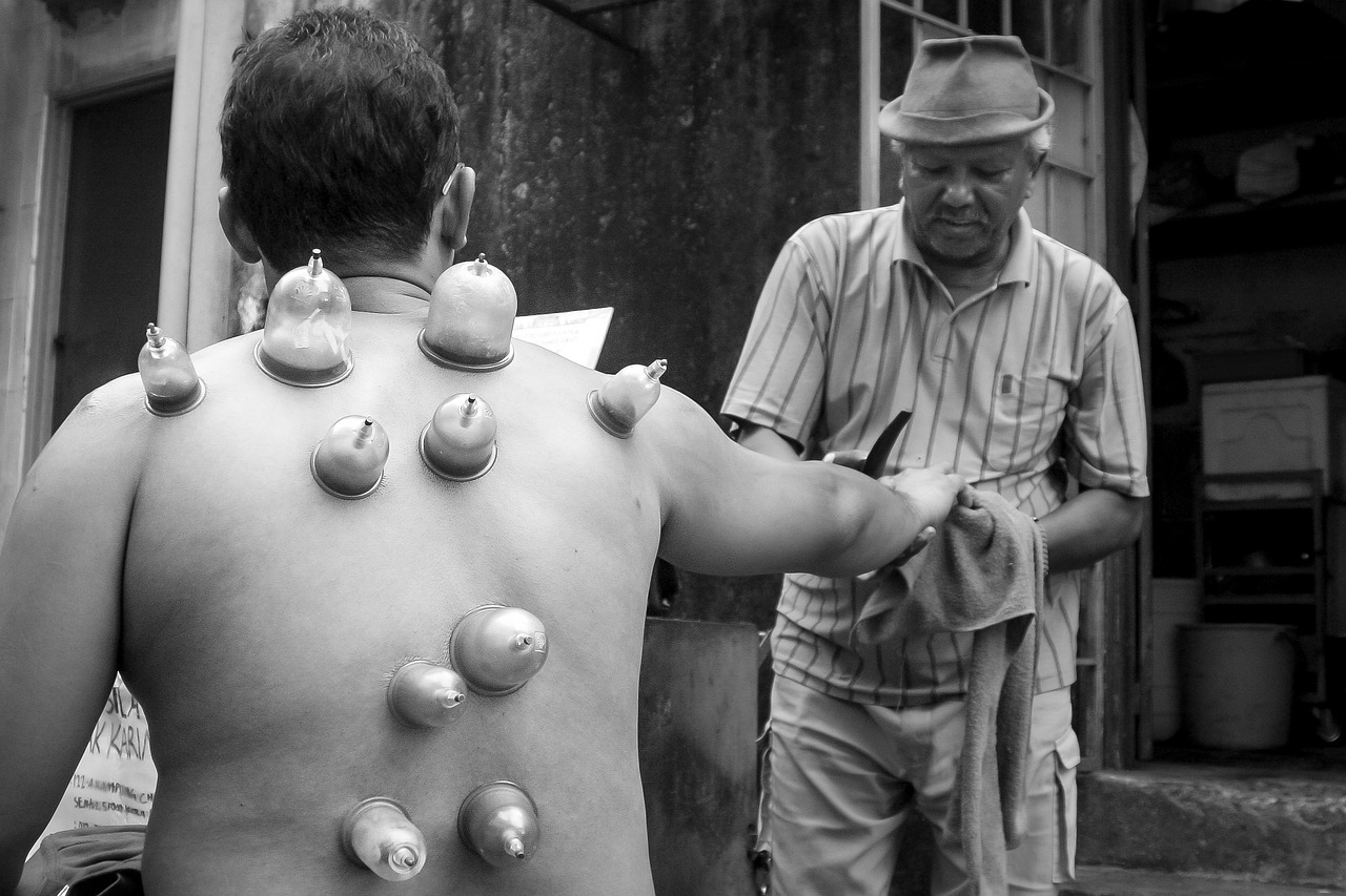 a black and white photo of a man with apples on his back, a photo, by Joze Ciuha, flickr, process art, bells, acupuncture treatment, calcutta, coneheads