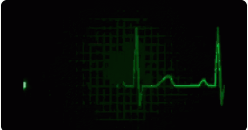 a green heartbeat pattern with an abstract design