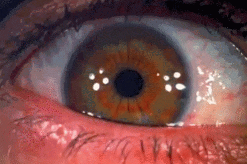a close - up view of the eye of an adult