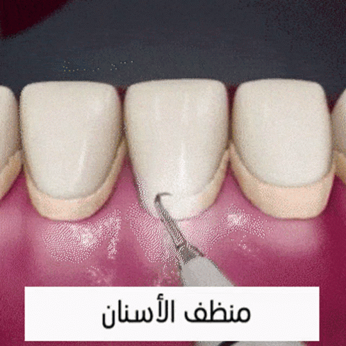 a dentist's view of the teeth with the top part removed