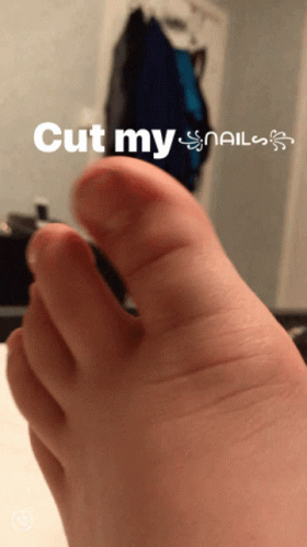 thumb showing a thumb with cutmy nails