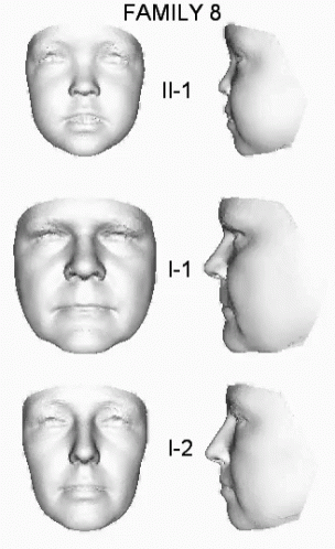 a series of head images showing the stages for a woman's head