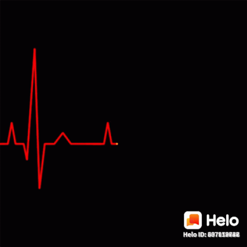 an ecg cardiogram is shown on a black background