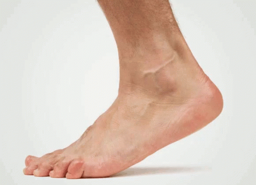 the feet of an injured person with light blue colored skin