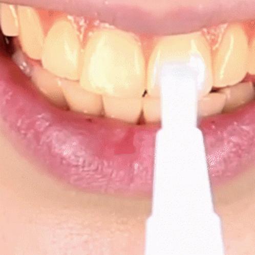 a person that is brushing his teeth with white gums