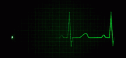 a wave is created from an ecg, with green and black colors