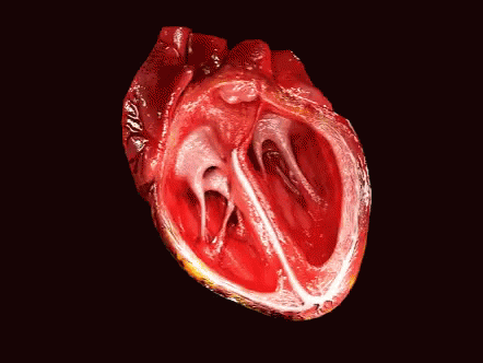 the picture shows the side of a heart with vein