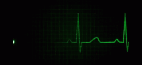 a green heartbeat with light coming out of the end