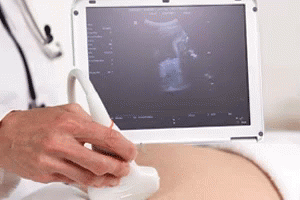 the computer screen is being used to see a medical scan