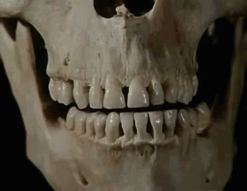the skull of a zombie is shown with its teeth missing
